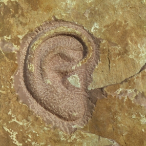 Accidents e malsognas